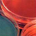 Fill material industry Fill material industry